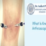 Dr. Aniket patil-knee replacement surgeon