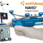 Robotic Joint Replacement Surgery with Navio Surgical System