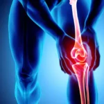 Rheumatoid Arthritis Treatment Specialist